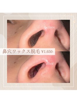 ホワイトアイ 堺東(WHITE EYE)/◇鼻穴ワックス脱毛スタート!!