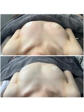 モア(moa)/デコルテからふっくら！