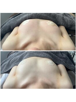 モア(moa)/デコルテからふっくら!