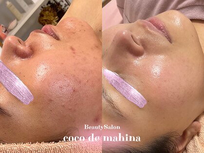 ココマヒナ(coco de mahina)の写真