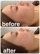 ギンザアール(GINZA R.)/すっきり小顔に◎