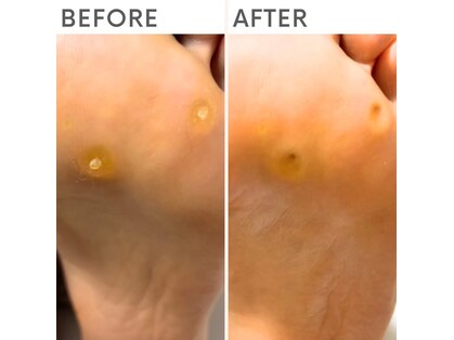 クオッカ(Quokka)の写真