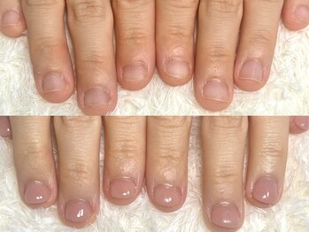 グラシナ 鳥丸店/(深爪/長さだし/フィルイン/)