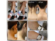  Before・After写真 