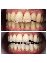 ムーンルーム(moon room)/歯科提携ホワイトニング