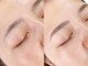 ホワイトアイ 横浜(WHITE EYE)の写真/【美眉アイブロウ+フェイスWAX(額orフェイスライン)】古い角質を落としワントーンUPした美肌に!!