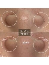 サロンドシェフィア(Salon de Chefia)/30代女性 症例写真