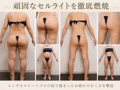 スカイ(Sky)の写真
