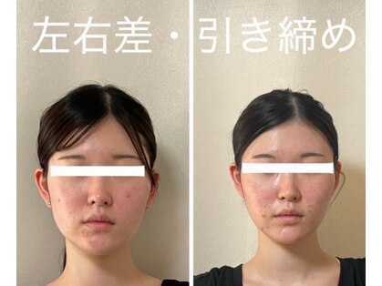 ミラ 長崎駅前店(MIRA)の写真