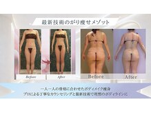 メルローズ 自由が丘店(Melrose)の雰囲気（メルローズのメソッドで、食事制限することなく楽にガリ痩せ♪）