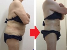 カブール 町田店/70歳代でも美しく変身です！