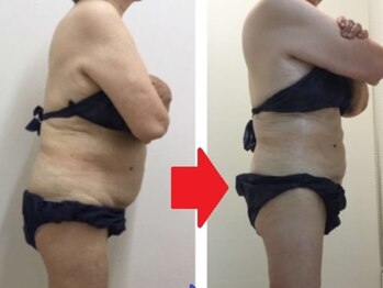 カブール 町田店/70歳代でも美しく変身です！