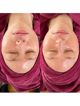 ボニータ(Bonita)/年齢が出やすい目元ぎりぎりまで