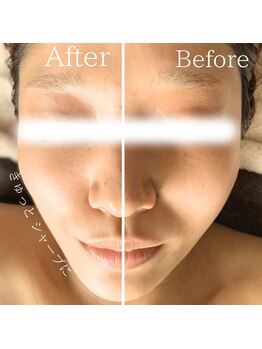 ジュアン バイ ジネン(Jeune by Jinen)/余分な水分老廃物を徹底的に流す