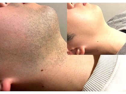 ブレイヴ(BRAVE)の写真