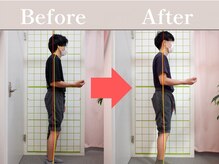 やわた姿勢整体院/23歳男性