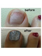 エナジー オブ グレース(energy of grace)/足の爪こそ欠けたらケアを★