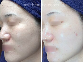 アート ビューティールーム(art beauty room)/☆XE'LHA PEEL （セラピール） 