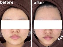 アヤエステティックサロン 綱島店(AYA)