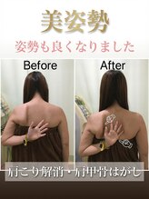 寝屋川まこと整骨院/【大阪寝屋川】肩こり改善美姿勢