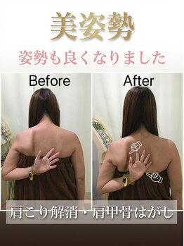 寝屋川まこと整骨院/【大阪寝屋川】肩こり改善美姿勢