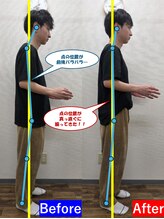 最後の整体 練馬駅前院/猫背でお悩みのお客様の姿勢変化