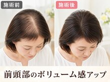 凛と慶/お客様の変化-9ヶ月