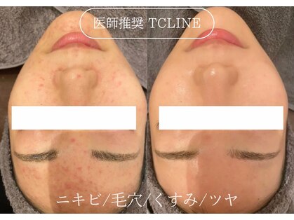 トップスキン 渋谷(TOPSKIN)の写真