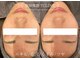 トップスキン 渋谷(TOPSKIN)の写真
