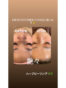 ベリーベリー 九条店(VERY-VERY)/