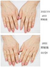 ネイル キャンバス シルヴァ(Nail Canvas Silva.)/美肌光エステ初回