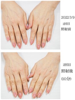 ネイル キャンバス シルヴァ(Nail Canvas Silva.)/美肌光エステ初回