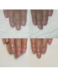 自爪を大切にする地爪育成ケア