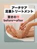 アーチケアトリートメント『足裏カウンセリング無料』