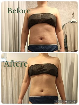 リープ(Lieb)/ボディビフォーアフター