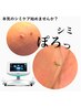お試しで始めてみたい方★スポットシミケア【２箇所】×7回　¥24500→¥19900