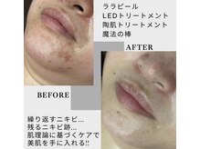 ベルグランツ(Belleglanz)の雰囲気(肌質や肌トラブルの原因に合わせてメニューを構成しています!)