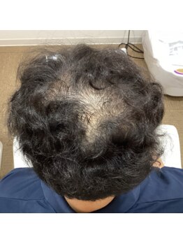 エルプラス(L+)/50代男性.１