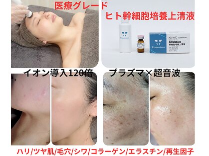 エスボーテ(sbeaute)の写真