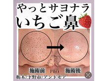 一度でも効果を実感