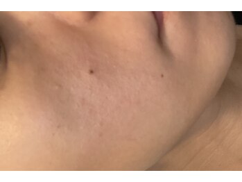 ペリドット(Peridot)/