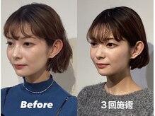 コルミチョン サロン(骨美整 salon)/Before・After(左右非対称施術)
