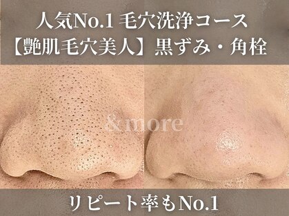 アンドモア(&more)の写真