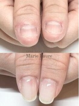 マリーロール 梅田店(Marie Laure)/自爪育成/深爪矯正/ネイルケア