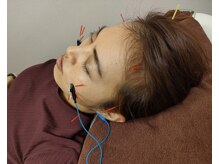 鍼灸院凪/カリム(Calme)/美容鍼