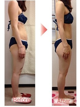 ピーキュア/2カ月ビフォーアフター