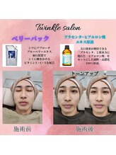 ティンクル サロン(Twinkle salon)/プレセンタ＆ヒアルロン酸エキス