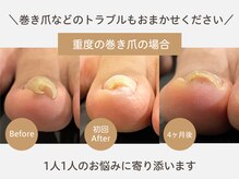 ナノ(Nail Salon NANO)