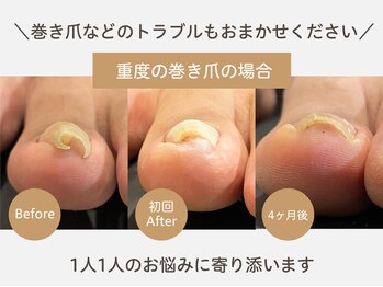 ナノ(Nail Salon NANO)