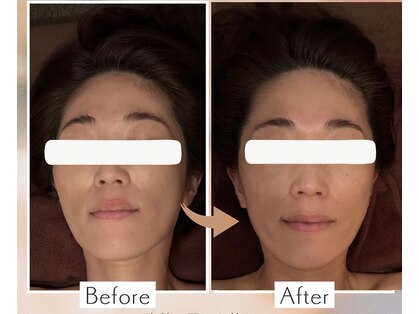 ローズボディ 恵比寿店の写真